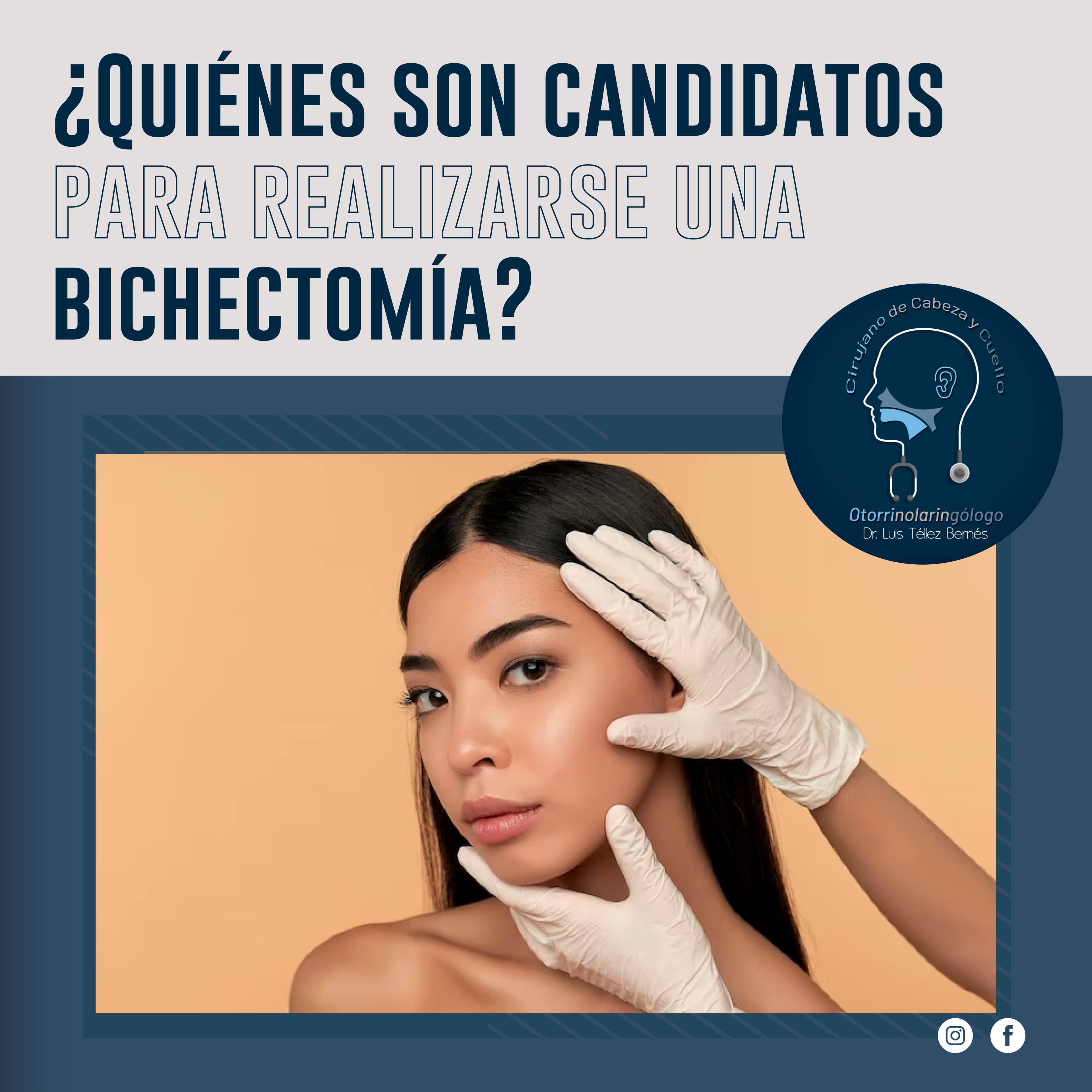 Resultados de Bichectomía