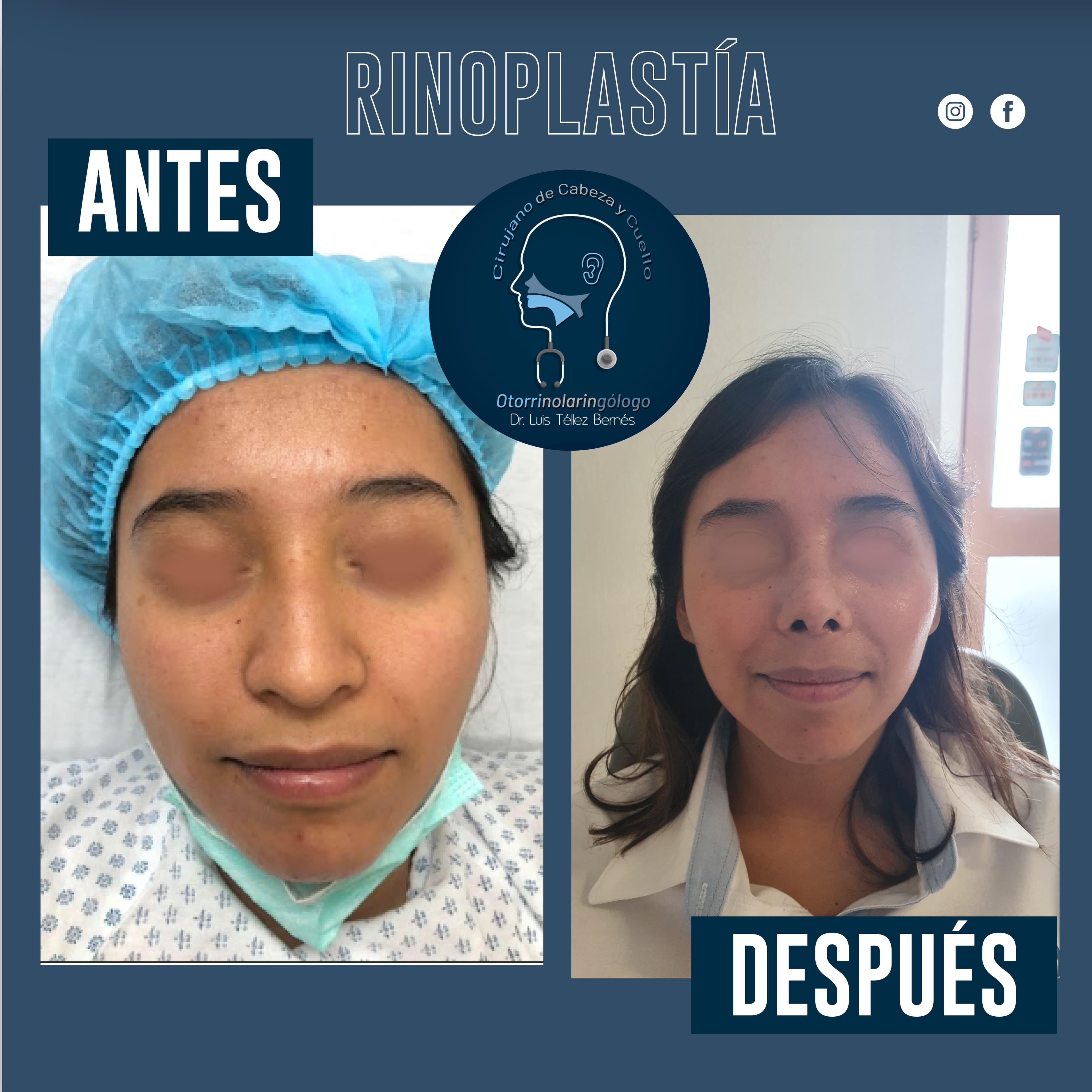 Resultado de tratamiento 1